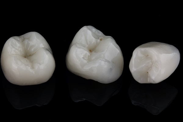 Types Of Dental Crowns: Which One Is Right For You?