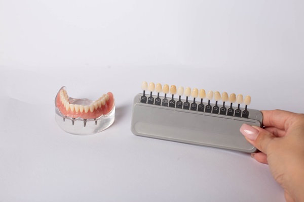 Why Choose Implant Supported Dentures? Top Benefits Explained